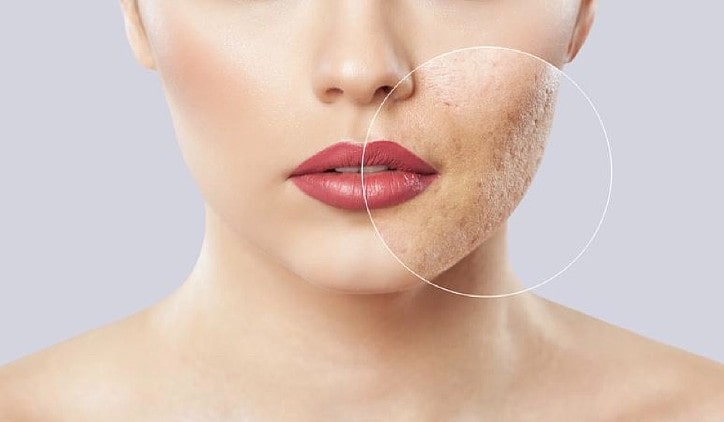 Lady with scars on her face