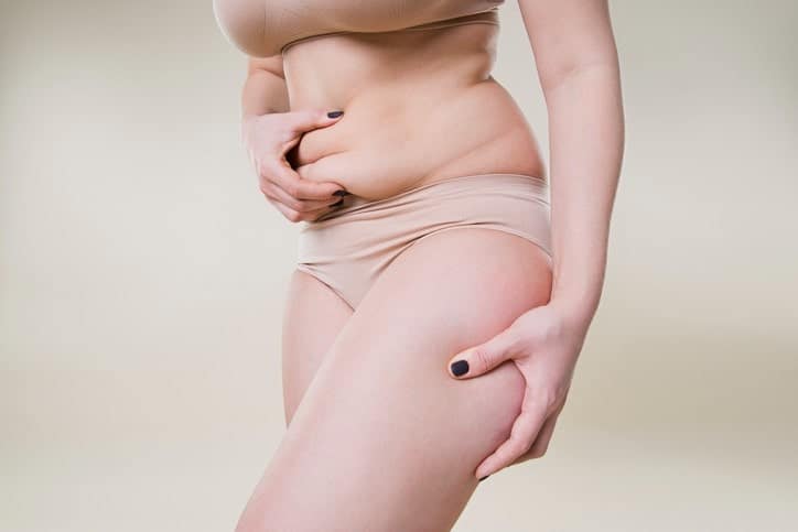 Cellulite
