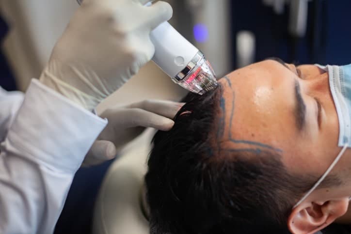 Dr Sam of Ozhean Zoey doing hair treatment