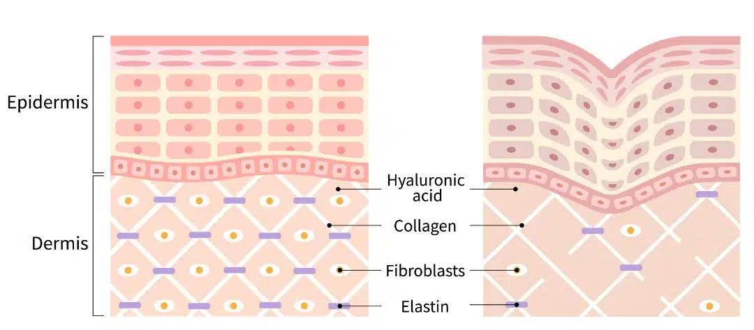 ageing skin
